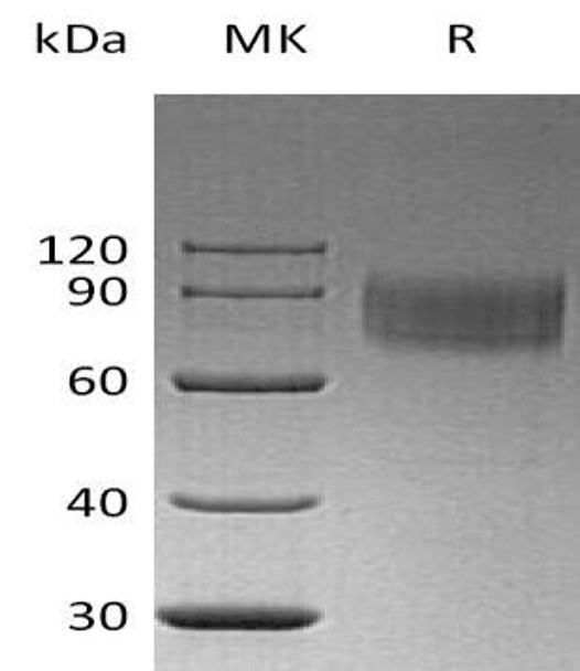 Human IFNAR1/IFNAR Recombinant Protein (RPES1762)