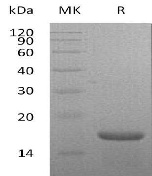 Mouse Interleukin-21/IL-21 Recombinant Protein (RPES1765)