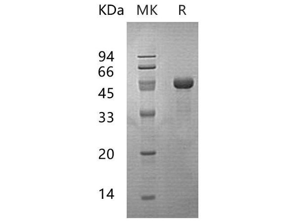 Human PPM1A Recombinant Protein (RPES1769)