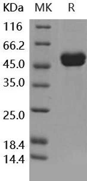 Human ILRA/IL1RN Recombinant Protein (RPES1775)