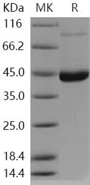 Human ENTPD5 Recombinant Protein (RPES1778)