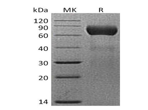 Mouse NTPDase 2/ENTPD2 Recombinant Protein (RPES1791)