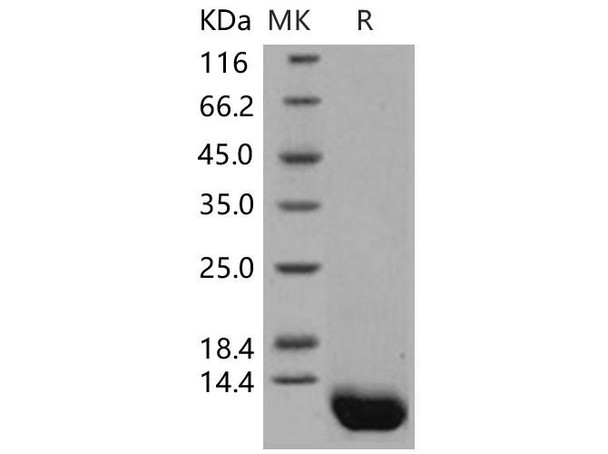 Human Complement C5a Recombinant Protein  (RPES1795)
