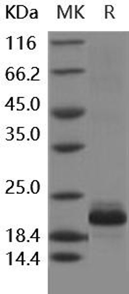 Human IL1F10/IL-38 Recombinant Protein (RPES1796)