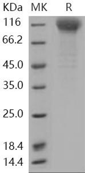 Human Nicastrin/NCSTN Recombinant Protein (RPES1799)