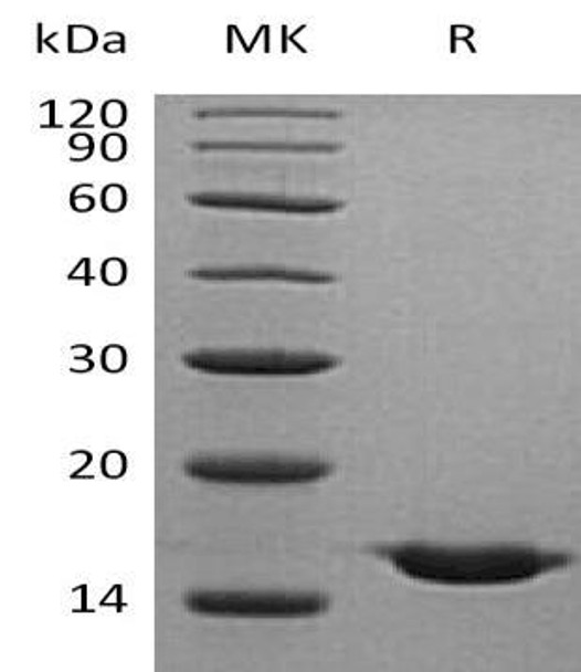 Human Cystatin SA/CST2 Recombinant Protein (RPES1801)