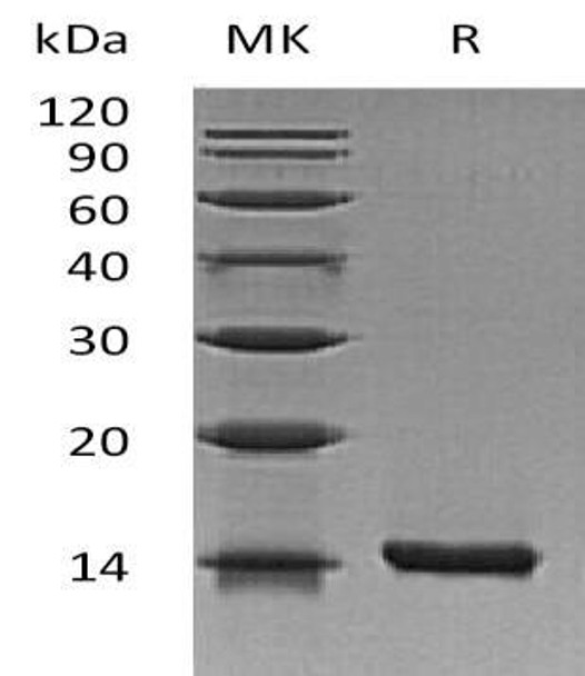 Mouse Interleukin-22/IL-22 Recombinant Protein  (RPES1806)