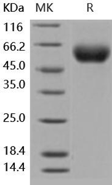 Human ILRAcP/ILR3 Recombinant Protein (RPES1816)