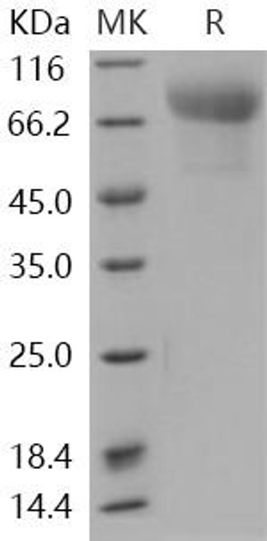 Human SynCam/CADM1 Recombinant Protein (RPES1819)