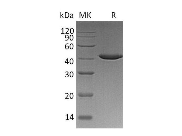 Human SERPINB9/PI-9 Recombinant Protein (RPES1829)