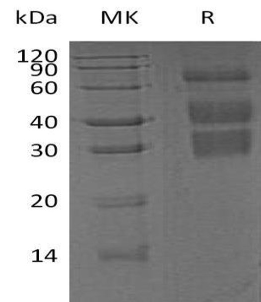 Mouse Clusterin/ApoJ Recombinant Protein (RPES1836)