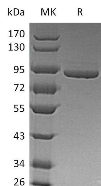 Human PFK1/PFKM Recombinant Protein (RPES1841)