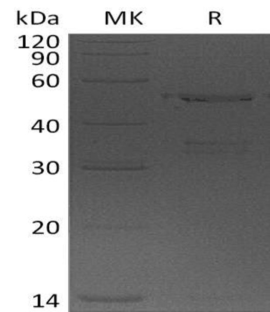 Human USP14 Recombinant Protein (RPES1842)