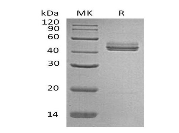 Mouse Interleukin-23/IL-23 Recombinant Protein (RPES1844)