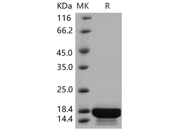 Human Interleukin-21/IL-21 Recombinant Protein  (RPES1853)