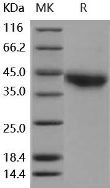 Human JAML/AMICA Recombinant Protein (RPES1854)