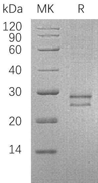 Human CRISP3/SGP28 Recombinant Protein (RPES1859)