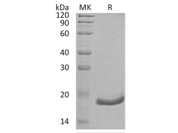 Human Interferon A-6/IFNA6 Recombinant Protein (RPES1860)