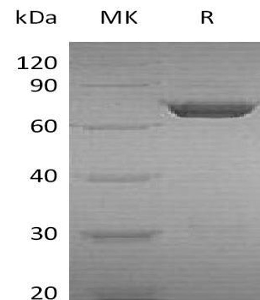 Human PGM2 Recombinant Protein (RPES1861)