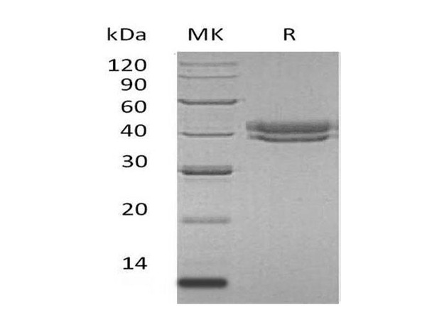 Human CFHR1 Recombinant Protein (RPES1867)