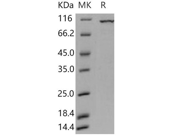 Human PKC iota/PRKCI Recombinant Protein (RPES1871)