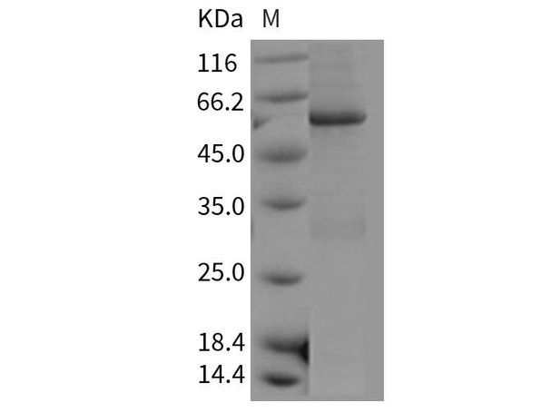 Mouse CDC2 Kinase/CDK1 Recombinant Protein (RPES1874)