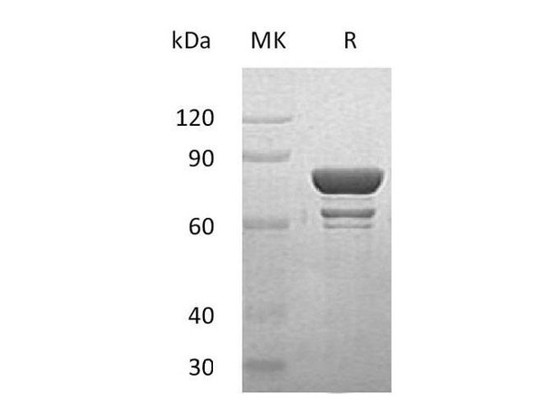 Human STAT1 Recombinant Protein (RPES1886)