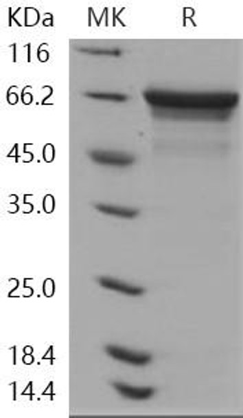 Human HSPA8/HSC70 Recombinant Protein (RPES1891)