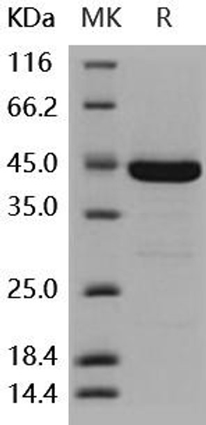 Human DUSP3/VHR Recombinant Protein (RPES1893)