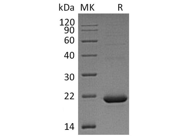 Human Cytochrome b5 B/CYB5B Recombinant Protein (RPES1898)