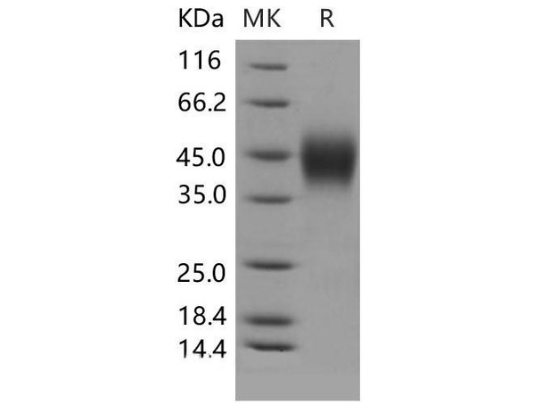 Mouse IFNGR1/CD119 Recombinant Protein (RPES1902)
