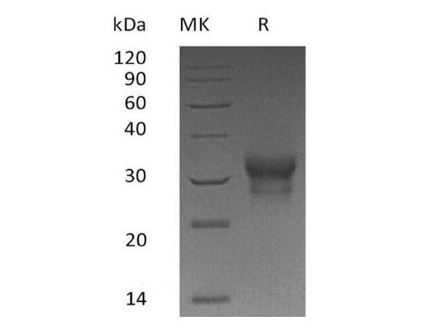 Human IFN-L1/IL-29 Recombinant Protein (RPES1908)