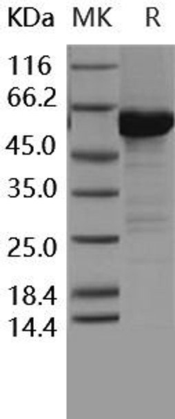 Human MKK6 Recombinant Protein (RPES1910)
