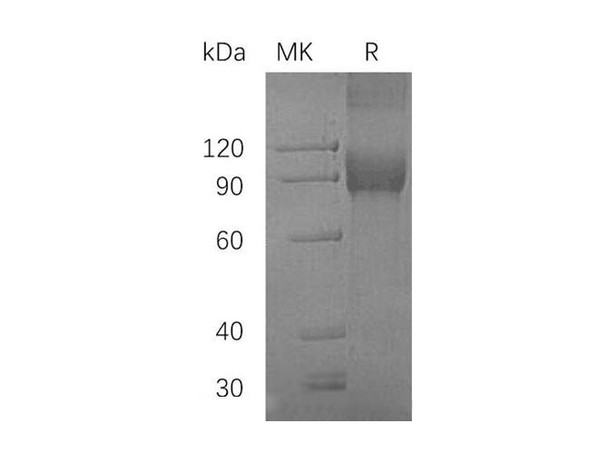 Human VCAM1 Recombinant Protein (RPES1914)