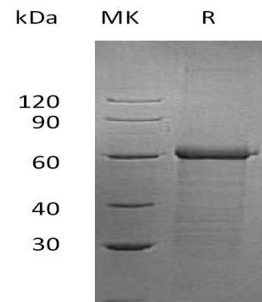 Human UBAP1 Recombinant Protein (RPES1922)