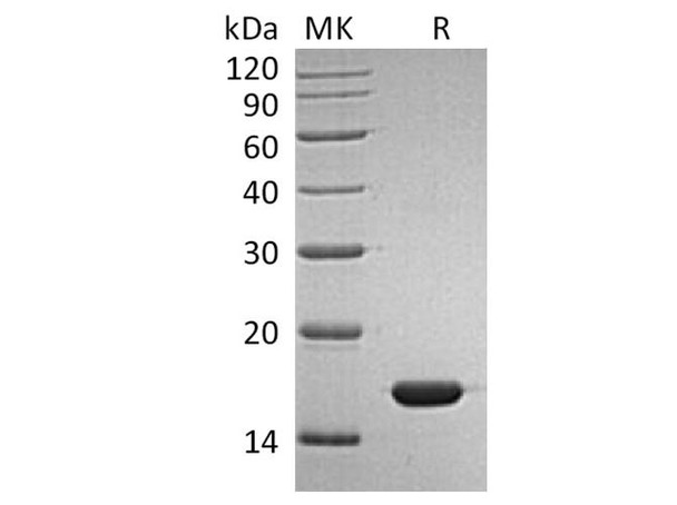 Human IFNA2b/IFNA2 Recombinant Protein (RPES1929)