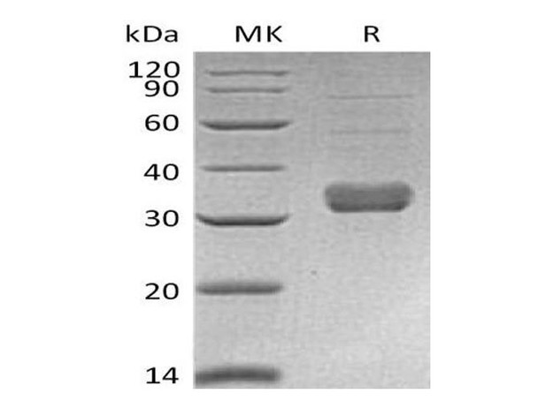 Mouse Collectin1/COLEC11 Recombinant Protein (RPES1930)