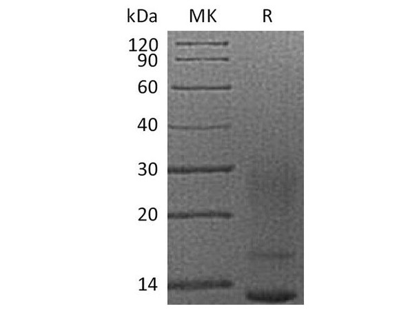 Human Interleukin3/IL3 Recombinant Protein (RPES1940)