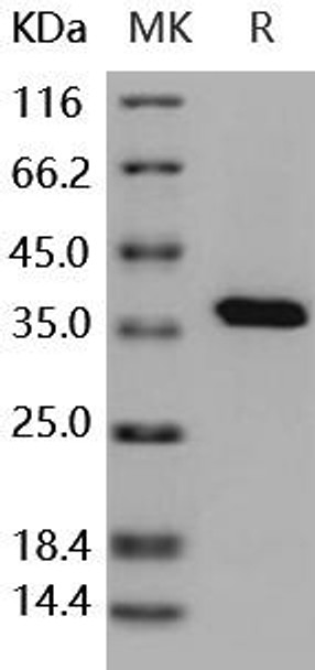 Human PTP1B/PTPN1 Recombinant Protein (RPES1951)