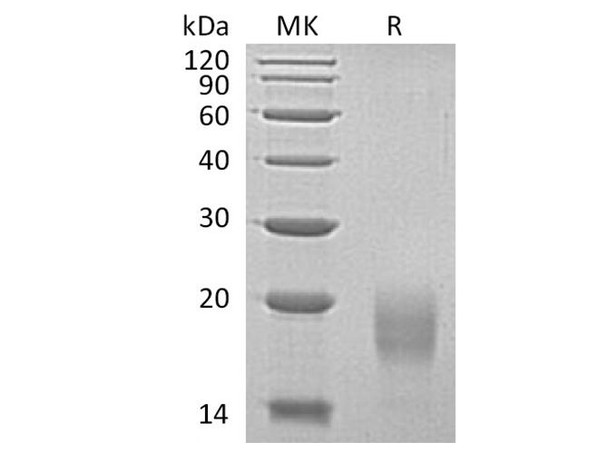 Human ALK4/ACVR1B Recombinant Protein (RPES1957)