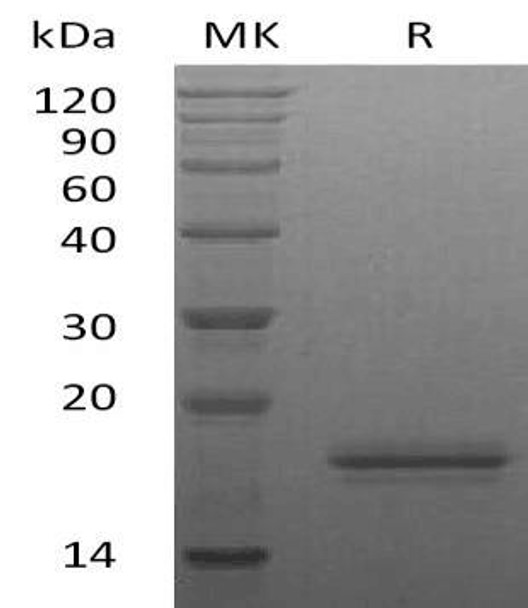 Human Interleukin6/IL6 Recombinant Protein (RPES1959)