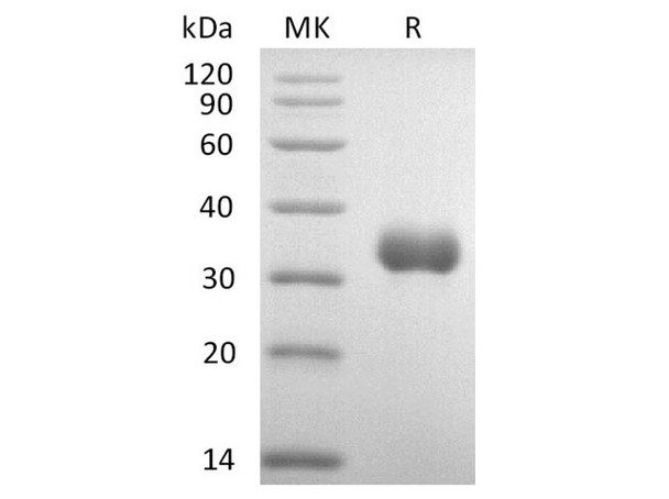Human IGFBP-7/IGFBP7 Recombinant Protein (RPES1968)
