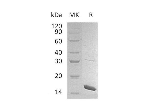 Mouse Interleukin-4/IL-4 Recombinant Protein (RPES1983)