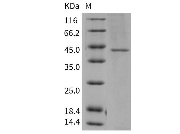 Human TCN2 Recombinant Protein (RPES1993)