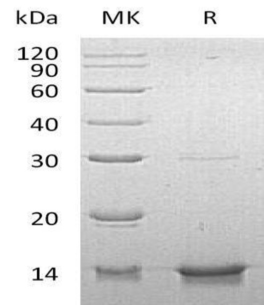 Human DYNLL1 Recombinant Protein (RPES1999)