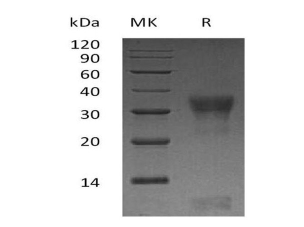 Human PIK3IP1 Recombinant Protein (RPES2001)