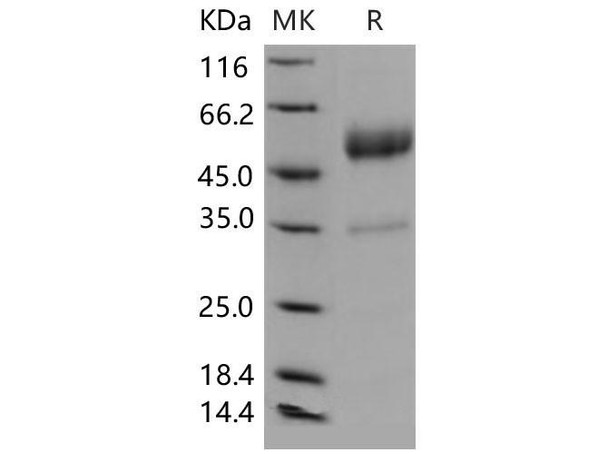 Mouse CD83/HB15 Recombinant Protein (RPES2003)