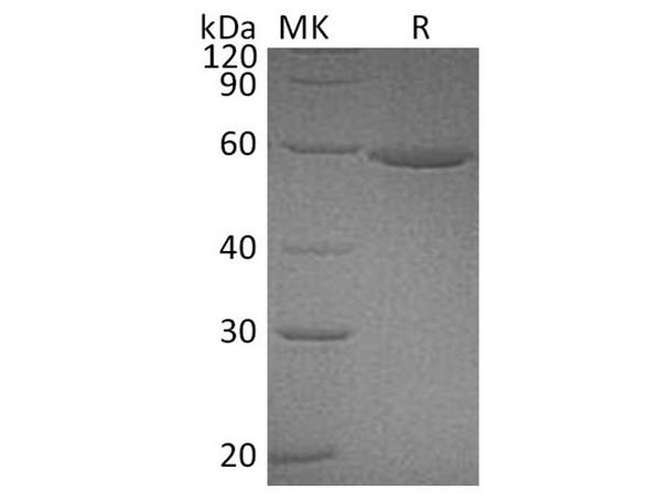 Human ALDH3A1 Recombinant Protein (RPES2008)