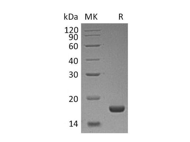 Human PLA2G1B/PLA2 Recombinant Protein (RPES2022)