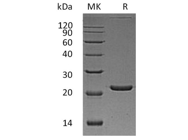 Human FTL Recombinant Protein (RPES2029)